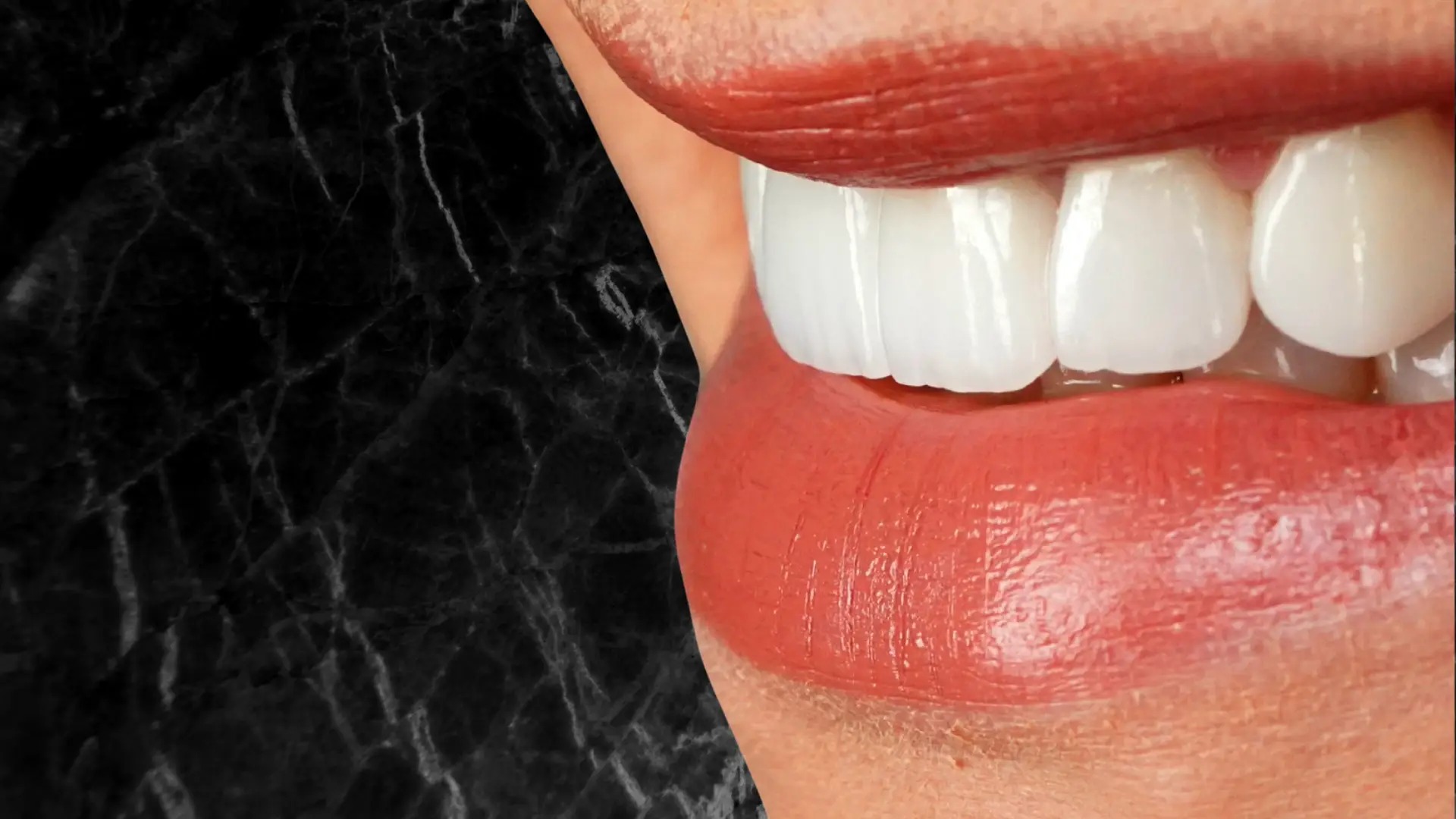 Invisalign: Frequently Asked Questions And Their Answers